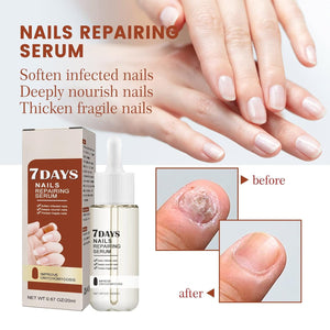 Nail Repairing Serum
