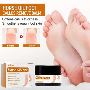 Horse Oil Foot Callus Remedy Balm