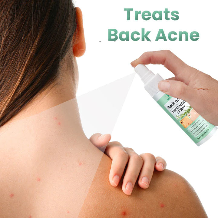 Back Acne Herbal Spray