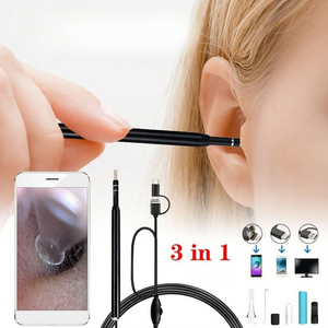 Ear-Cleaning Endoscope